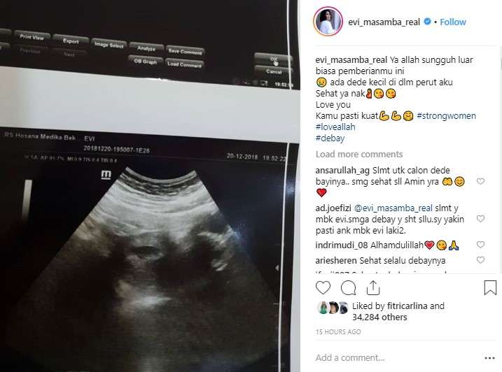 calon anak evi masamba