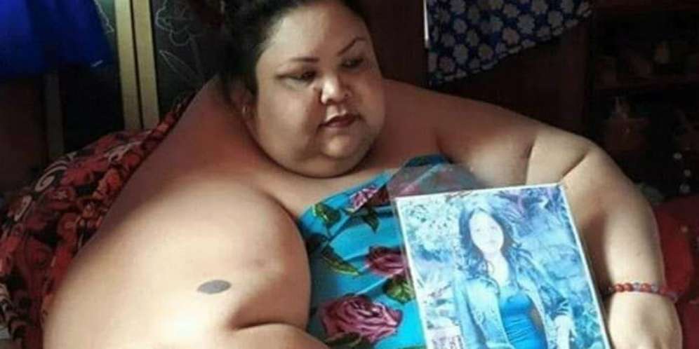 Derita Titi Wati, Tak Bisa Gerak Akibat Tubuh Berbobot 350 Kg