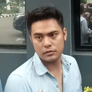 Keluar Ruang Pemeriksaan Mata Galih Ginanjar Merah, Kenapa?