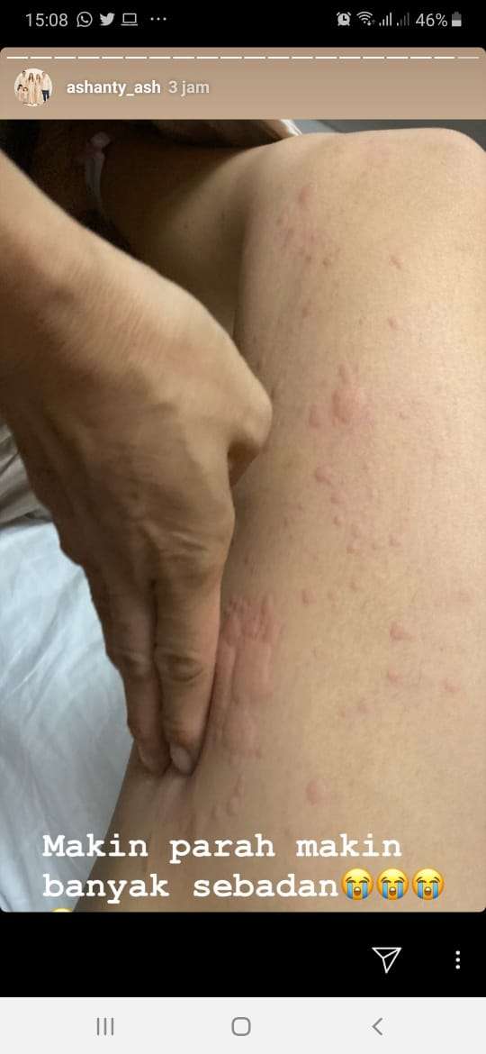kondisi ashanty kondisi ashanty