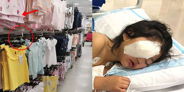 Nabrak Gantungan Baju dari Logam, Mata Gadis Ini Sobek dan Bulu Mata Tercabut