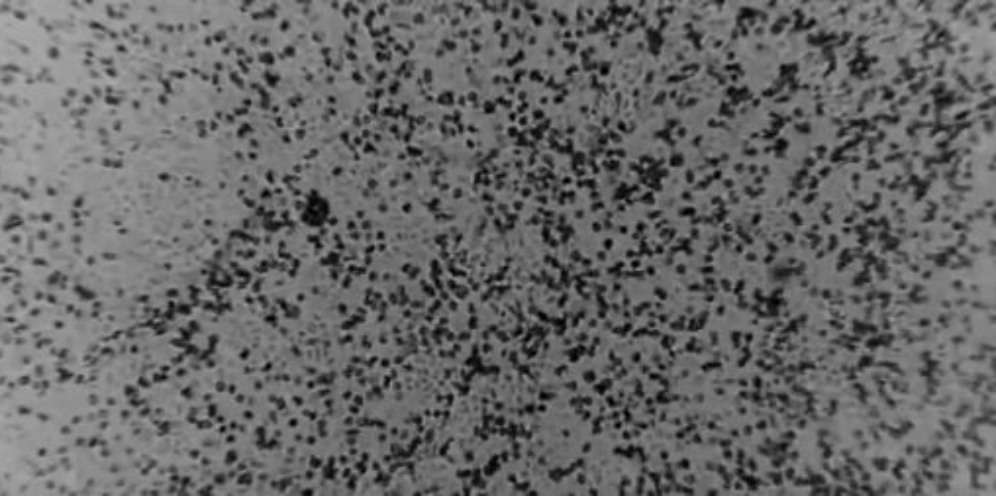 Penampakan Virus Corona Baru di Sel Tubuh Manusia