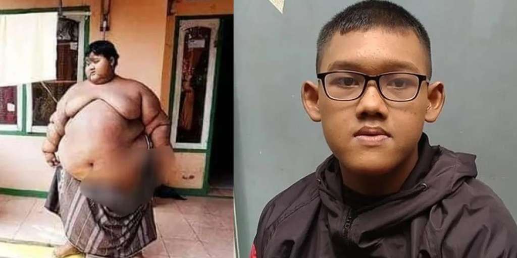 Transformasi Bocah Tergemuk di Dunia Arya Permana Dapat Sorotan Media Inggris, Disebut Tambah Ganten